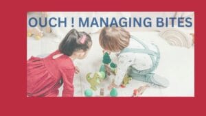 managing bites